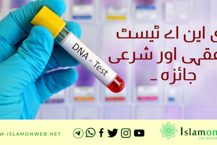 ڈی این اے ٹیسٹ کا فقہی اور شرعی جائزہ ۔۔