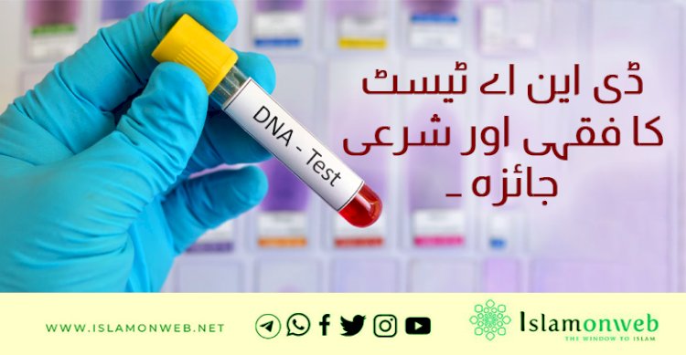 ڈی این اے ٹیسٹ کا فقہی اور شرعی جائزہ ۔۔